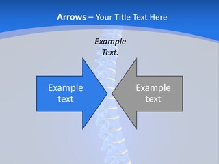 Rheumatism Slipped Disc PowerPoint Template