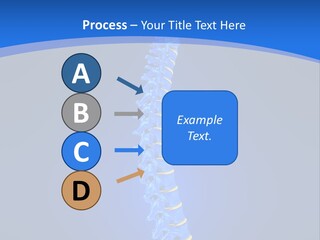 Rheumatism Slipped Disc PowerPoint Template