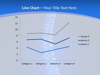 Rheumatism Slipped Disc PowerPoint Template