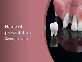 Orthodontic Pink Distraction PowerPoint Template