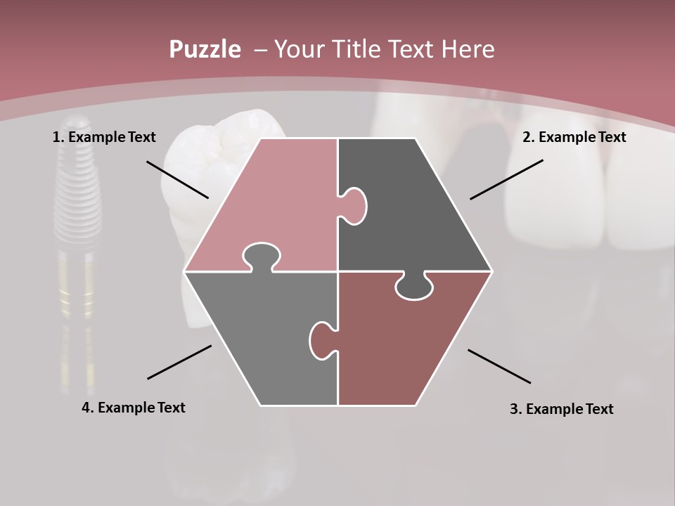 Orthodontic Pink Distraction PowerPoint Template