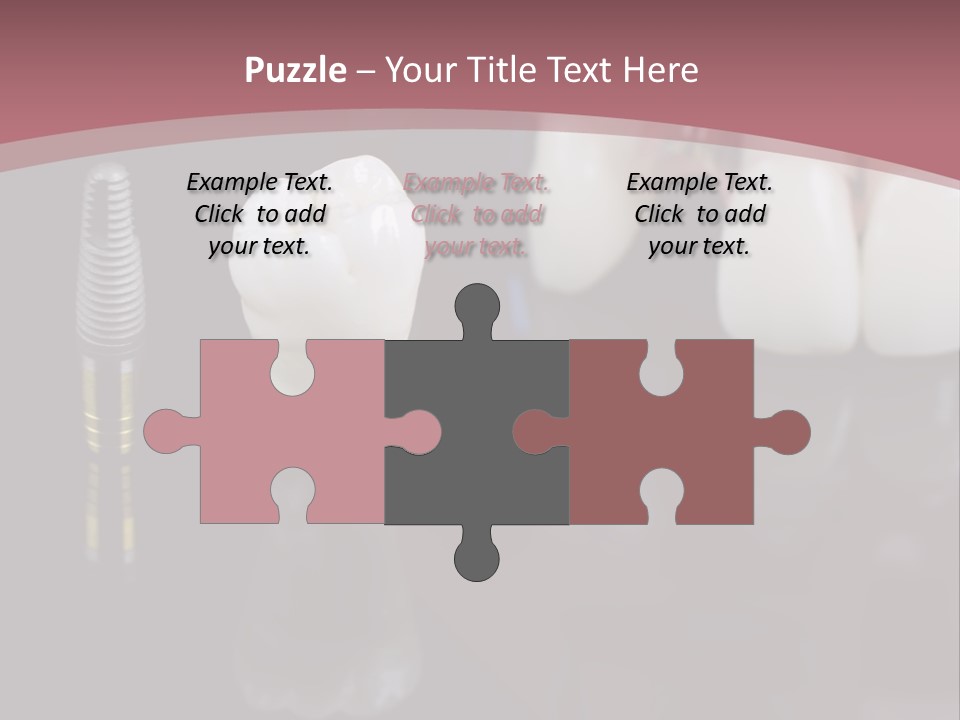 Orthodontic Pink Distraction PowerPoint Template