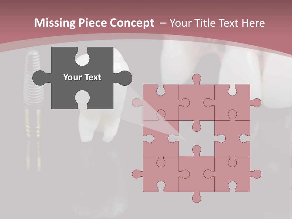 Orthodontic Pink Distraction PowerPoint Template