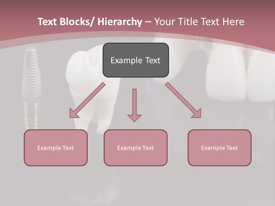 Orthodontic Pink Distraction PowerPoint Template