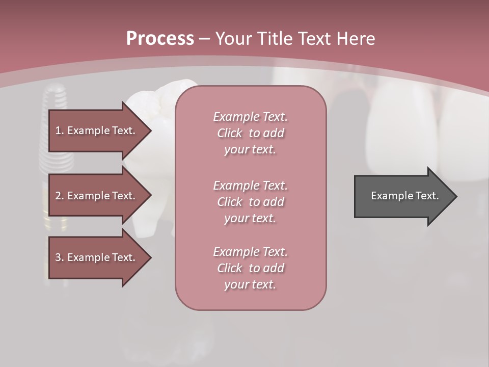 Orthodontic Pink Distraction PowerPoint Template