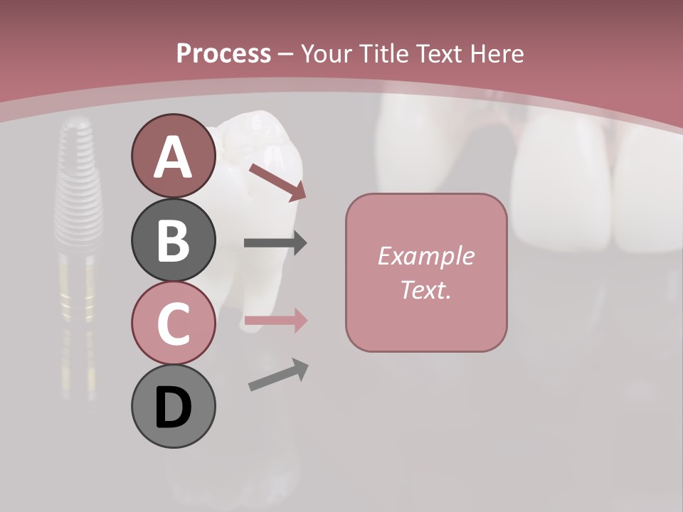 Orthodontic Pink Distraction PowerPoint Template