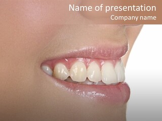 A Woman's Smile With A Missing Tooth PowerPoint Template