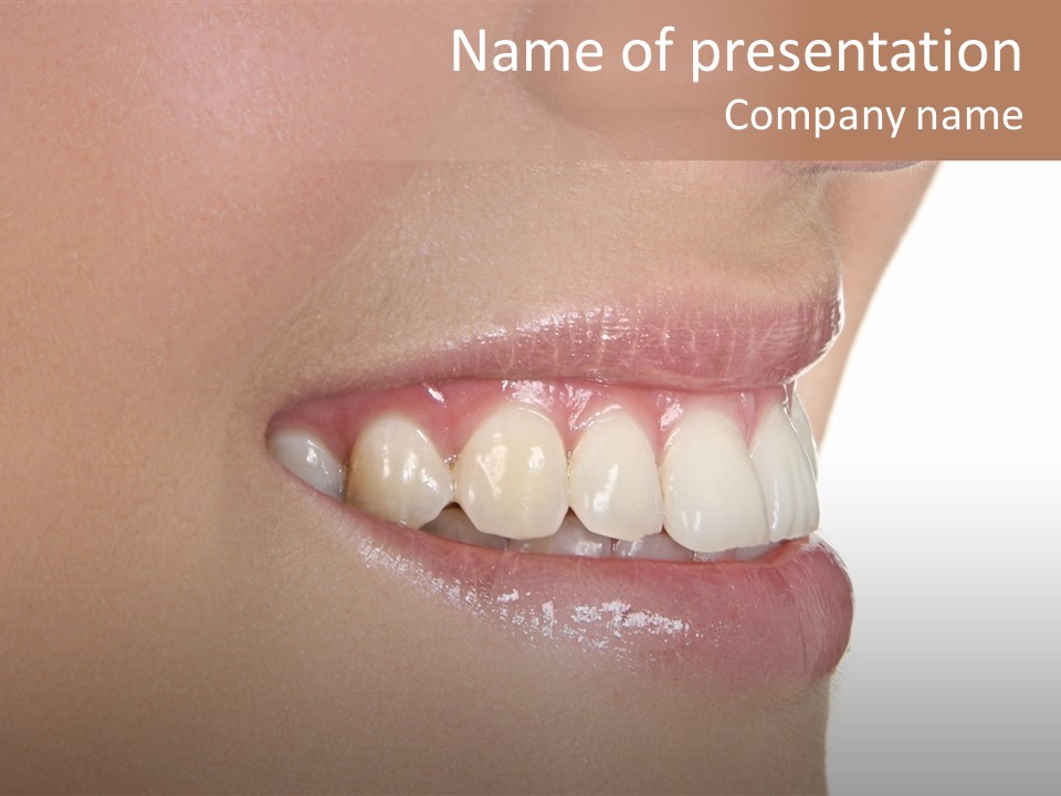 A Woman's Smile With A Missing Tooth PowerPoint Template