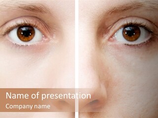 Depression Cicatrice Calm PowerPoint Template