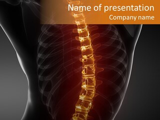 A Medical Powerpoint Presentation With A Skeleton PowerPoint Template