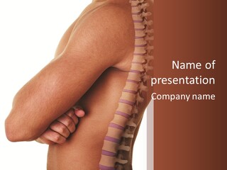 Medulla Injury Pangs PowerPoint Template