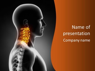 A Man With A Neck Pain Powerpoint Presentation PowerPoint Template