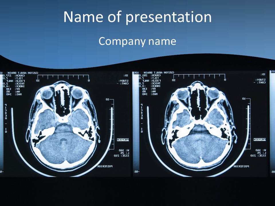 Picture Test Brain PowerPoint Template