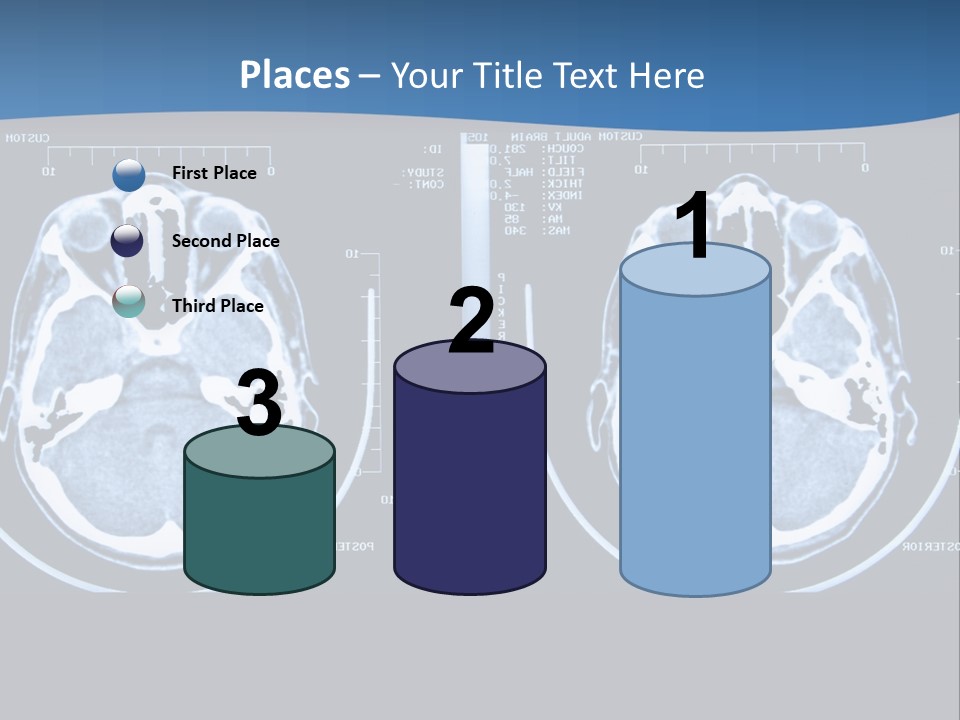 Picture Test Brain PowerPoint Template