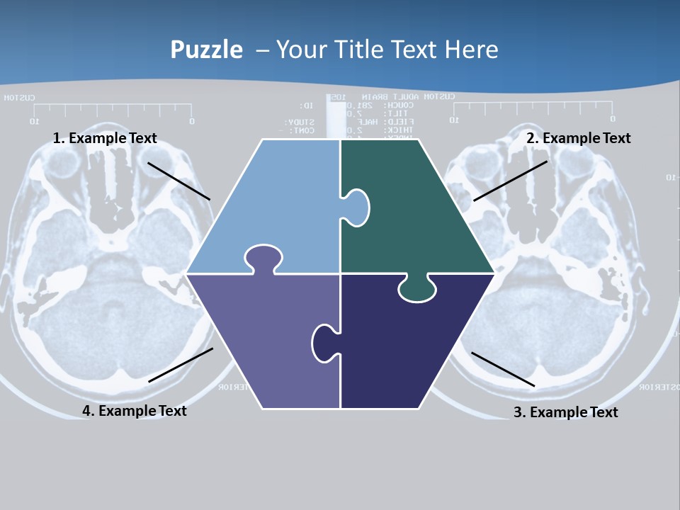 Picture Test Brain PowerPoint Template