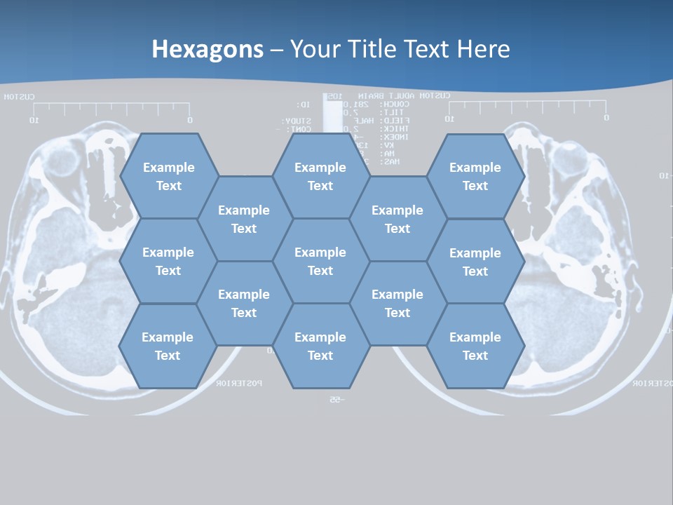 Picture Test Brain PowerPoint Template