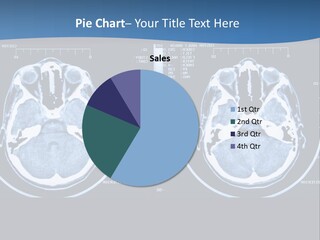 Picture Test Brain PowerPoint Template
