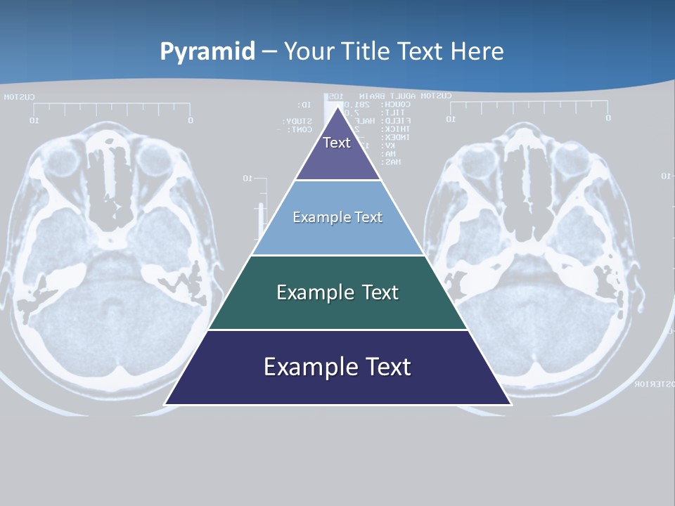 Picture Test Brain PowerPoint Template