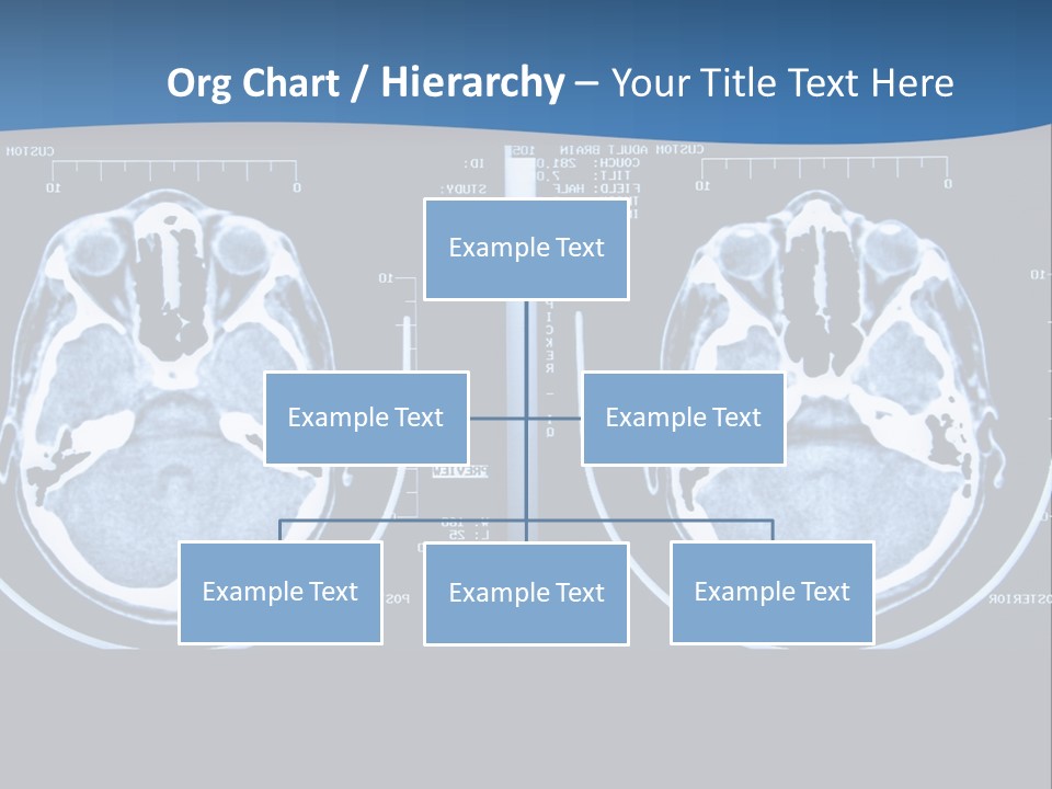 Picture Test Brain PowerPoint Template