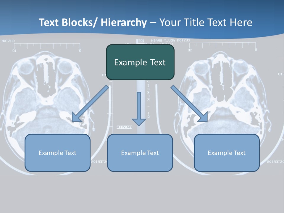Picture Test Brain PowerPoint Template