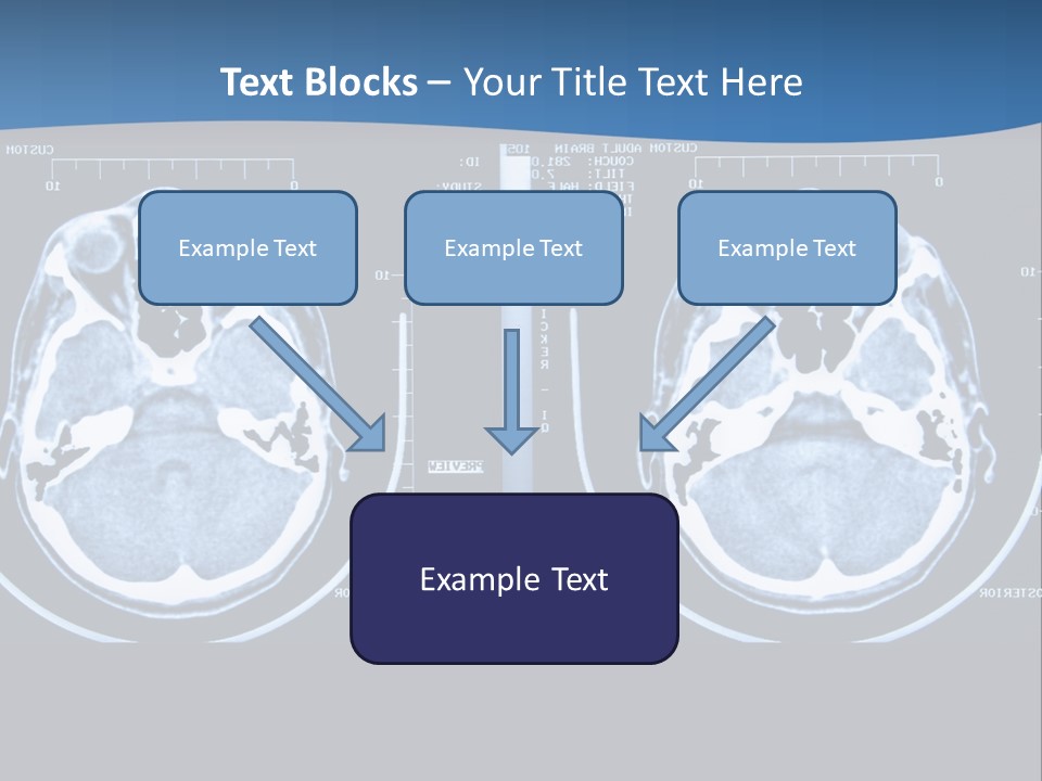 Picture Test Brain PowerPoint Template