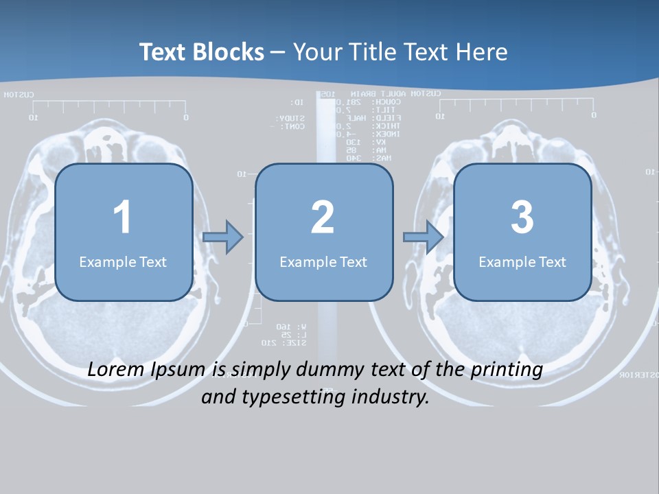 Picture Test Brain PowerPoint Template