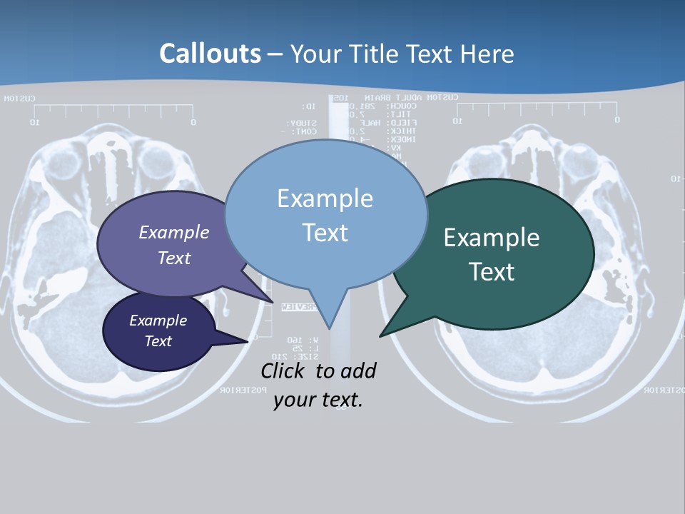 Picture Test Brain PowerPoint Template