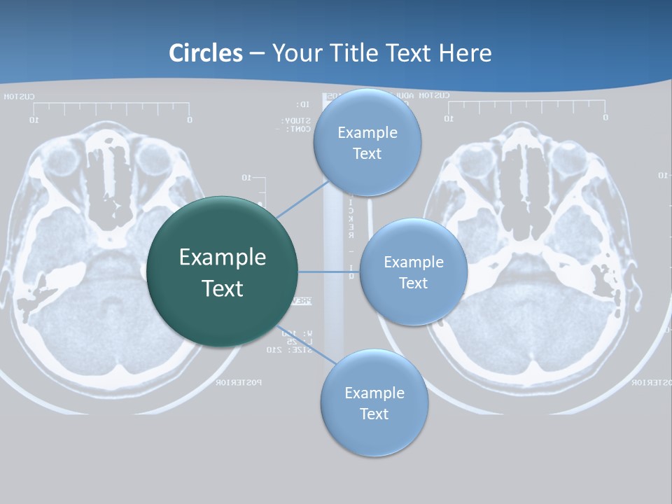 Picture Test Brain PowerPoint Template