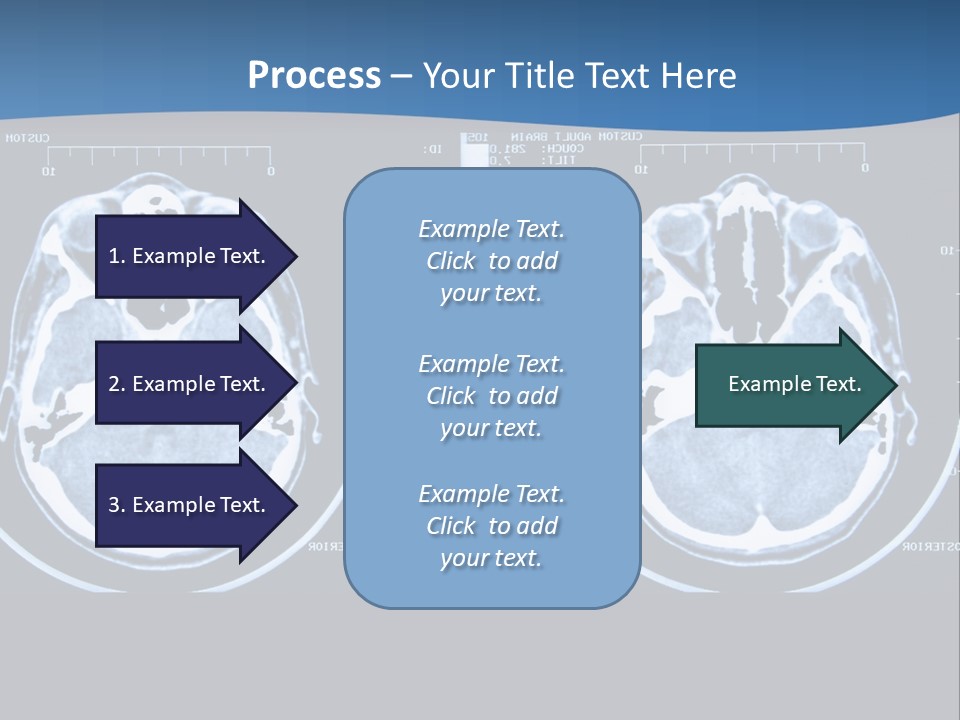 Picture Test Brain PowerPoint Template