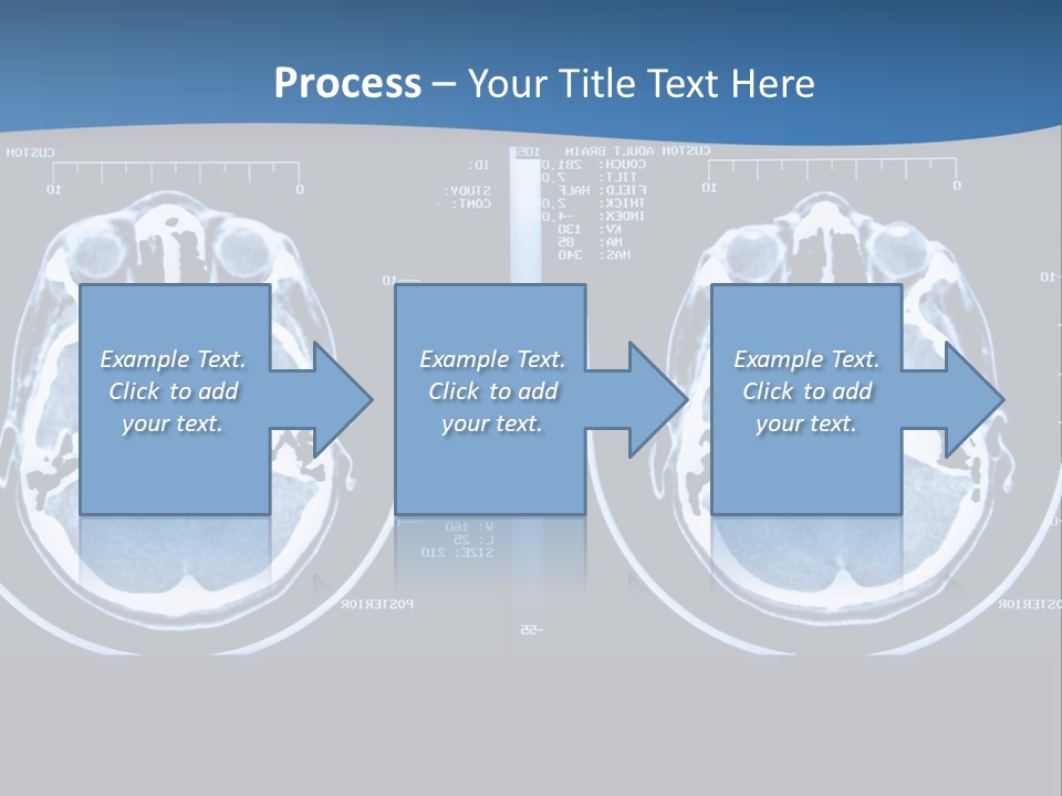 Picture Test Brain PowerPoint Template
