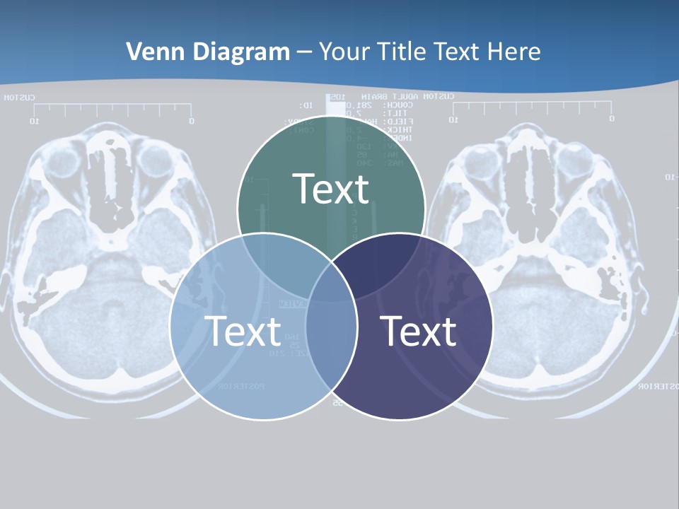 Picture Test Brain PowerPoint Template