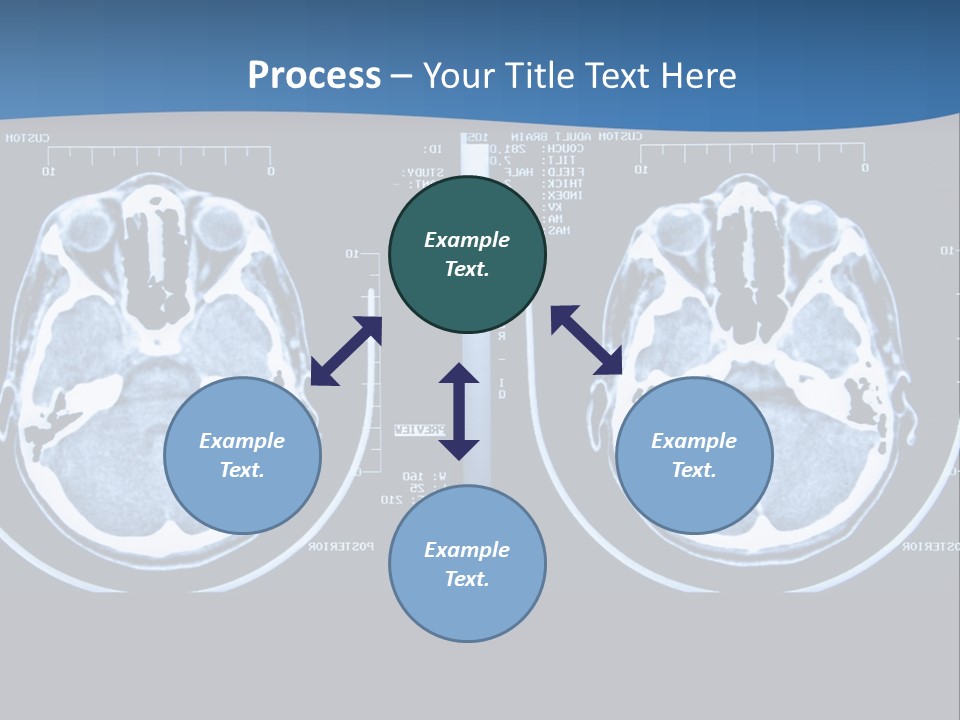 Picture Test Brain PowerPoint Template