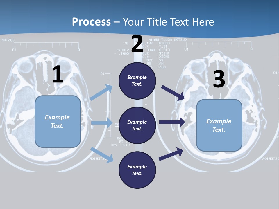 Picture Test Brain PowerPoint Template