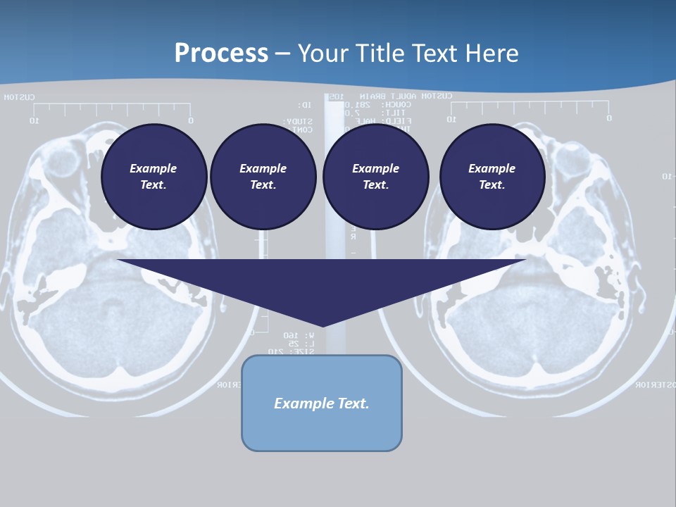 Picture Test Brain PowerPoint Template