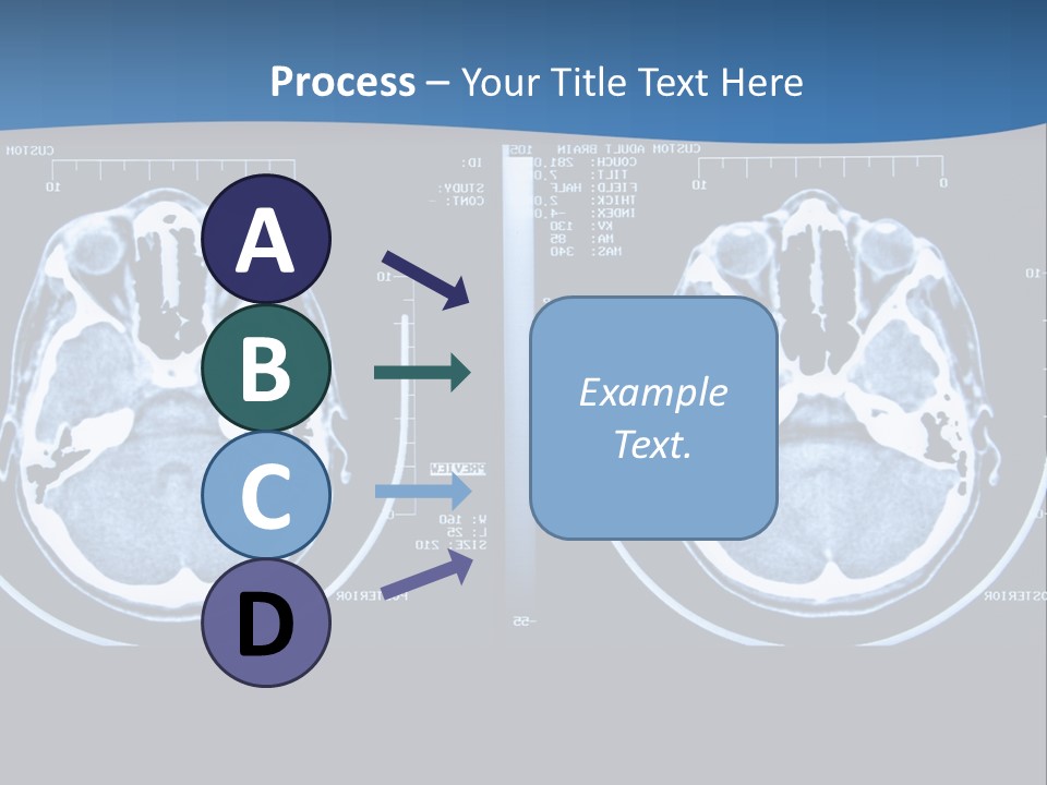 Picture Test Brain PowerPoint Template
