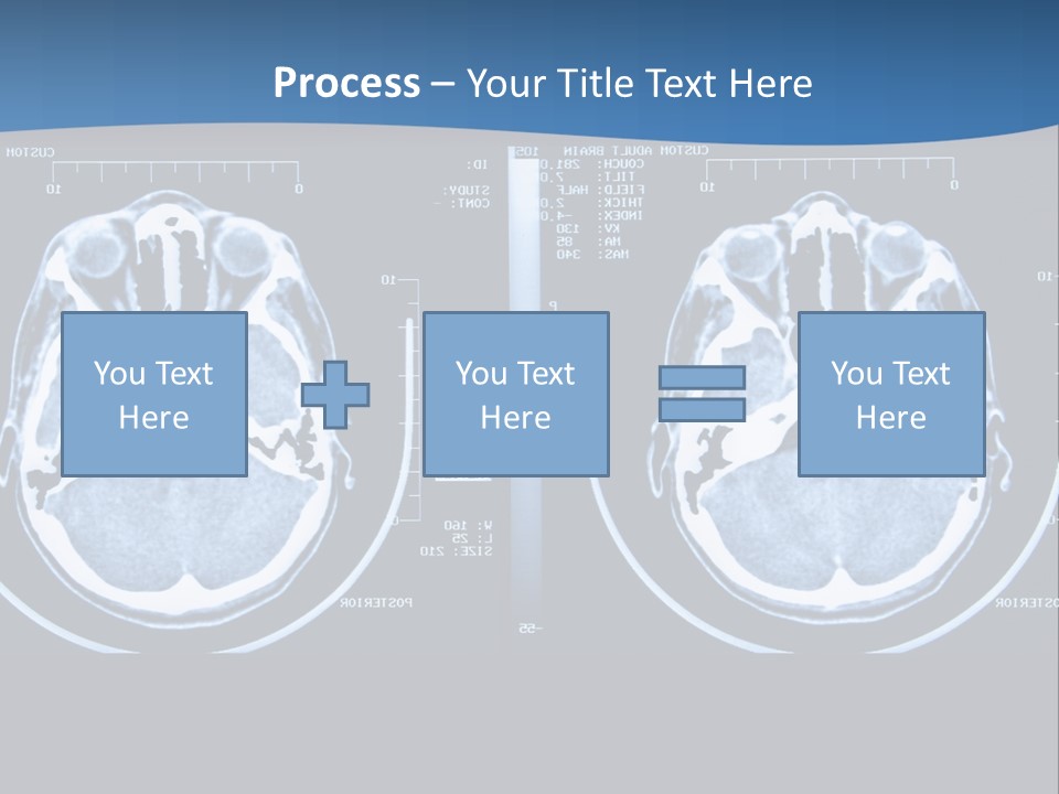 Picture Test Brain PowerPoint Template