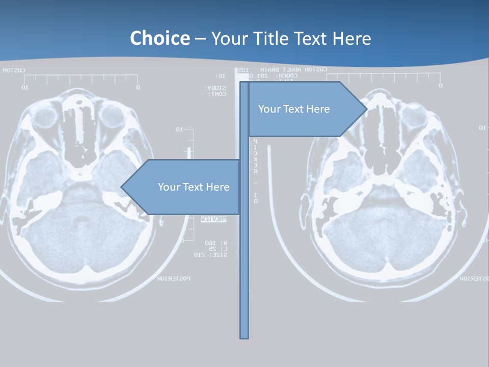 Picture Test Brain PowerPoint Template
