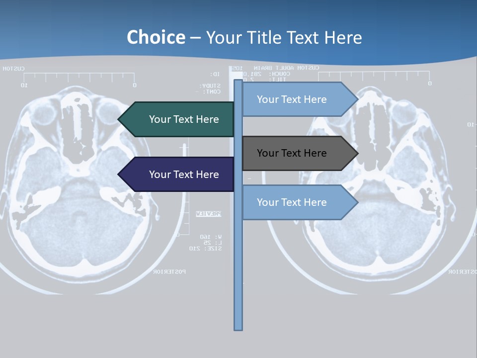 Picture Test Brain PowerPoint Template