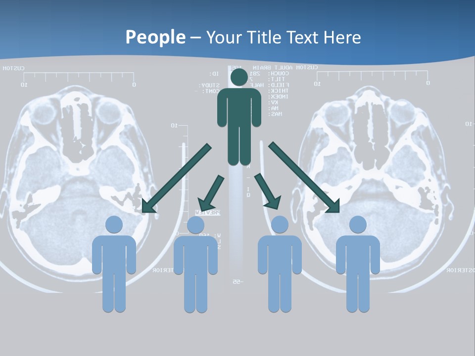 Picture Test Brain PowerPoint Template