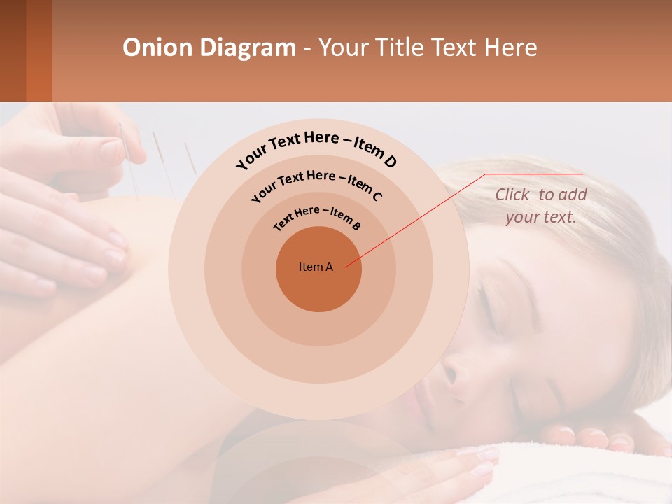 A Woman Getting A Massage With Needles On Her Back PowerPoint Template