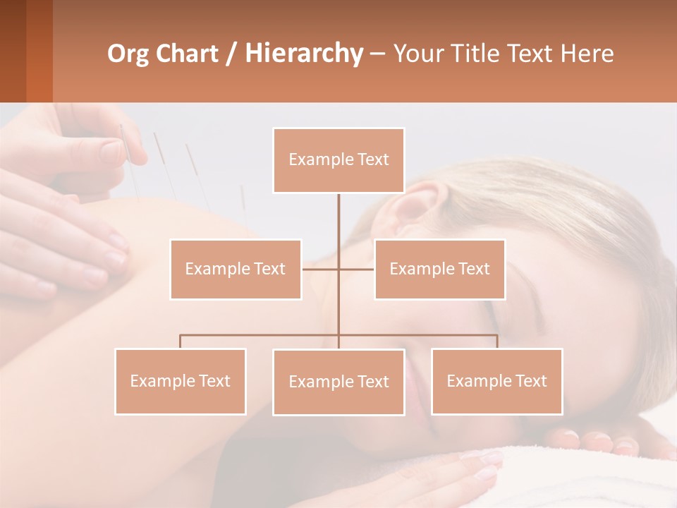 A Woman Getting A Massage With Needles On Her Back PowerPoint Template