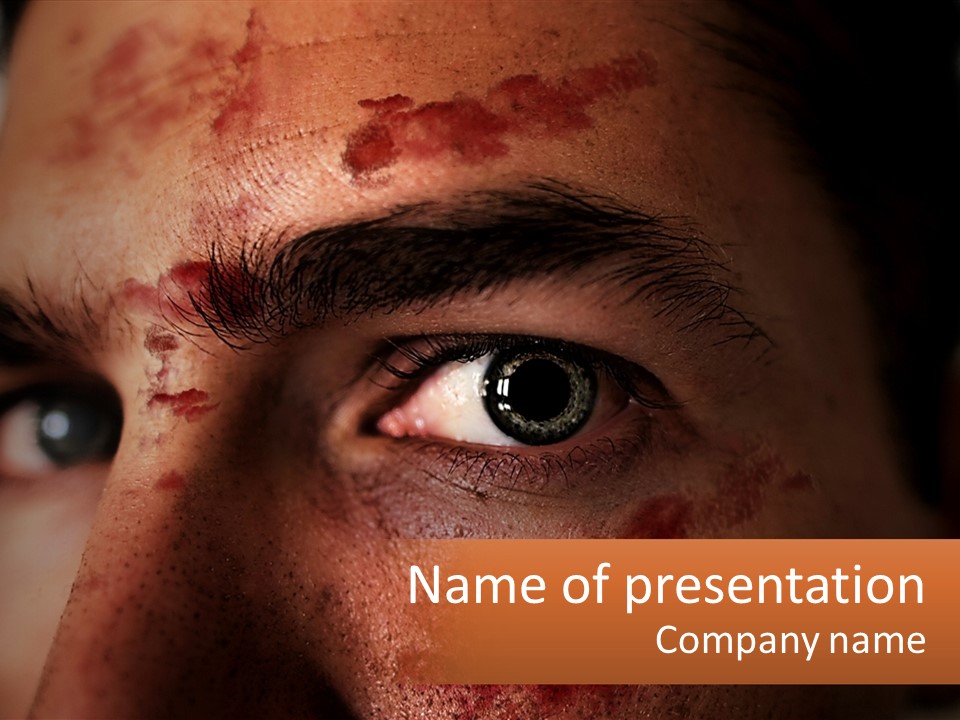 Blood Pain Scabs PowerPoint Template