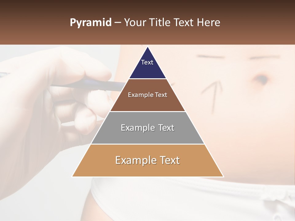 Procedure Correction Medical PowerPoint Template