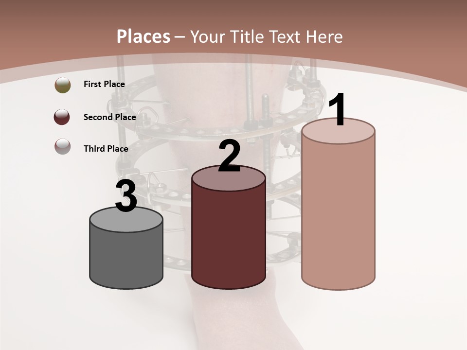 Bone Health Isolated PowerPoint Template