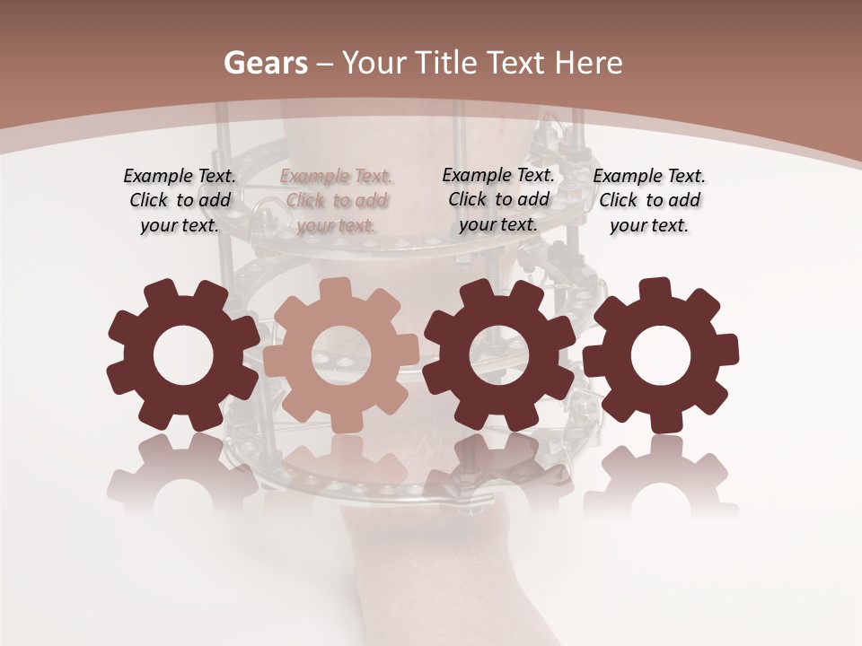 Bone Health Isolated PowerPoint Template