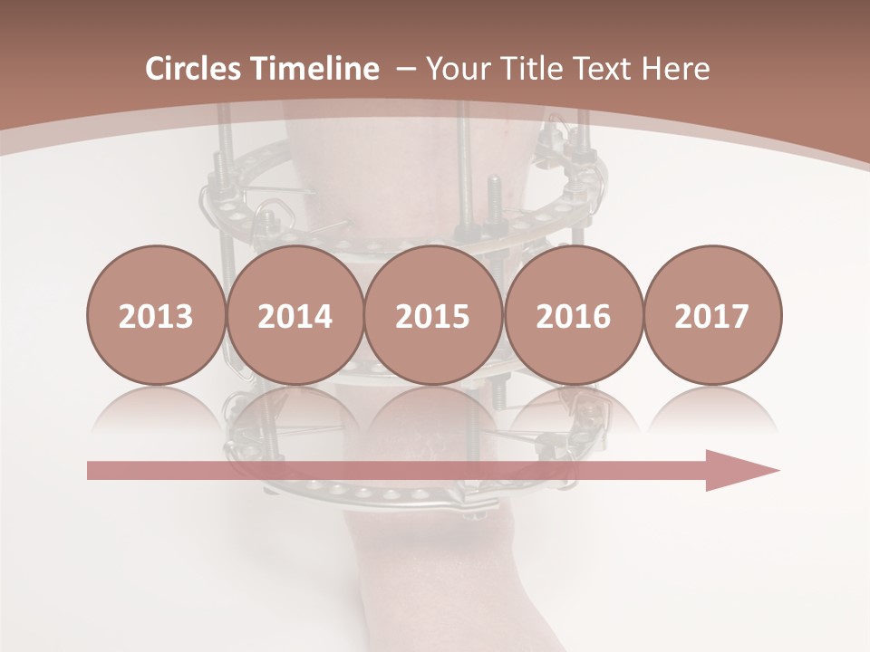 Bone Health Isolated PowerPoint Template