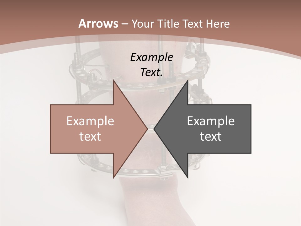 Bone Health Isolated PowerPoint Template