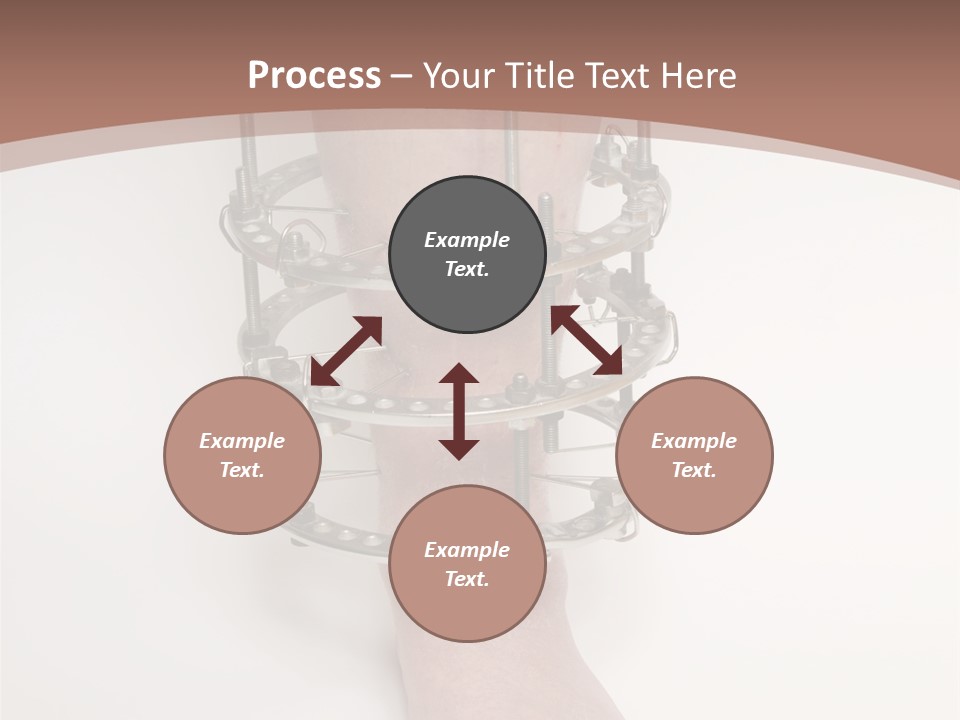 Bone Health Isolated PowerPoint Template