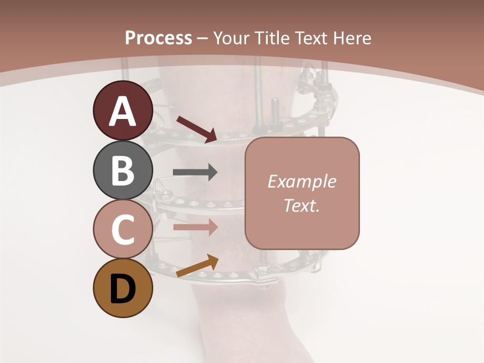 Bone Health Isolated PowerPoint Template