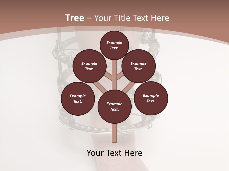 Bone Health Isolated PowerPoint Template